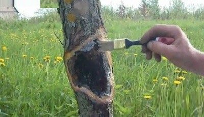 Traitement des endroits touchés par le cancer noir photo